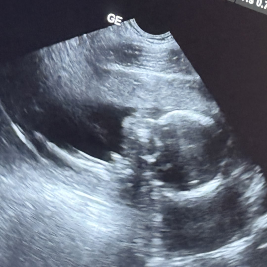 Photo shared by Savannah for their Babylist baby registry.
