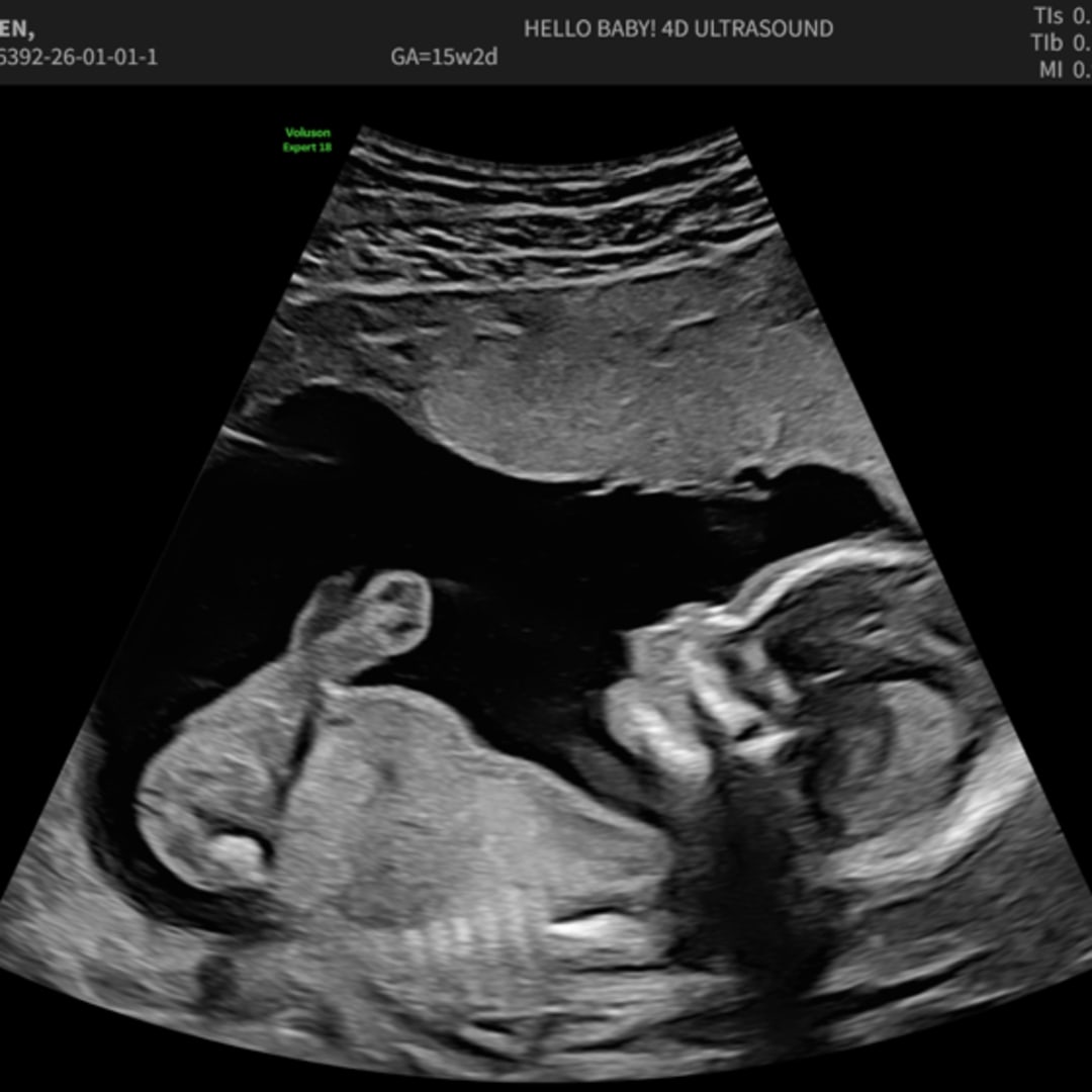 Photo shared by Kayla for their Babylist baby registry.