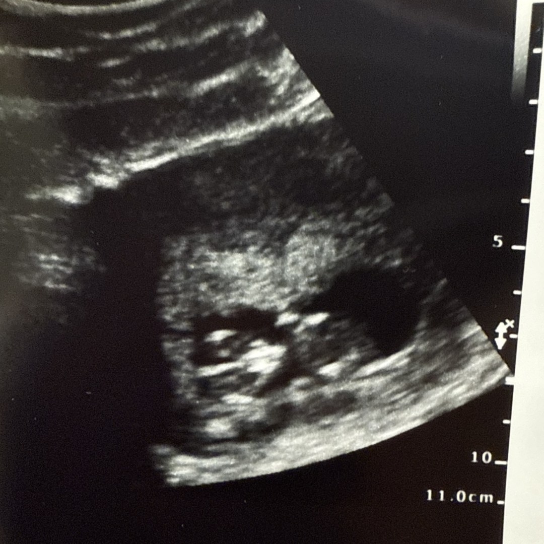 Photo shared by Lauren for their Babylist baby registry.