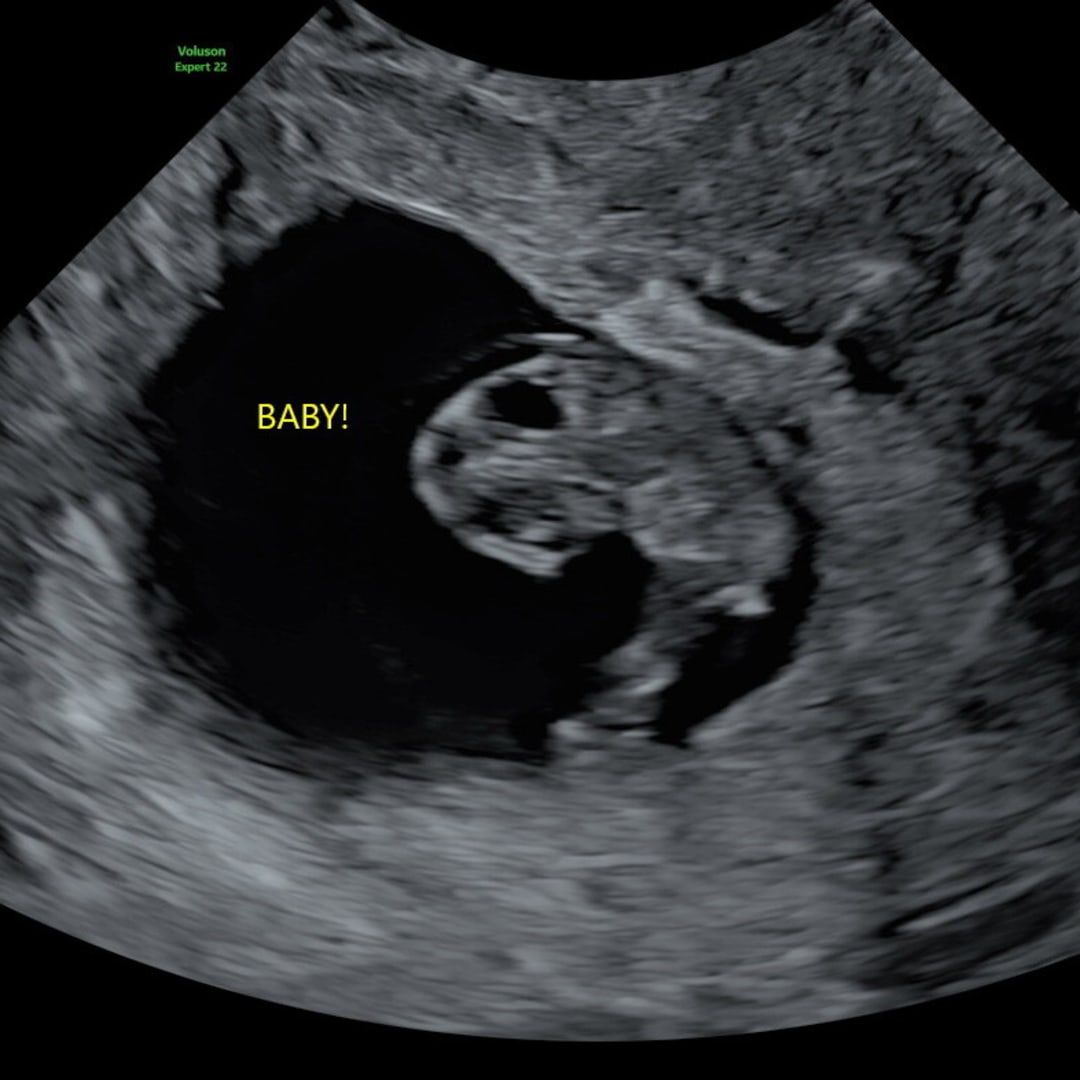 Photo shared by Britni for their Babylist baby registry.