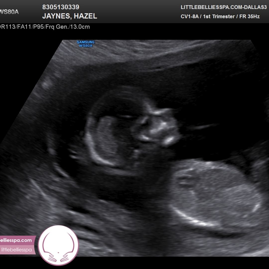 Photo shared by Hazel for their Babylist baby registry.