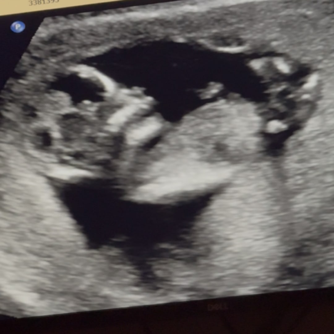 Photo shared by Brianna for their Babylist baby registry.
