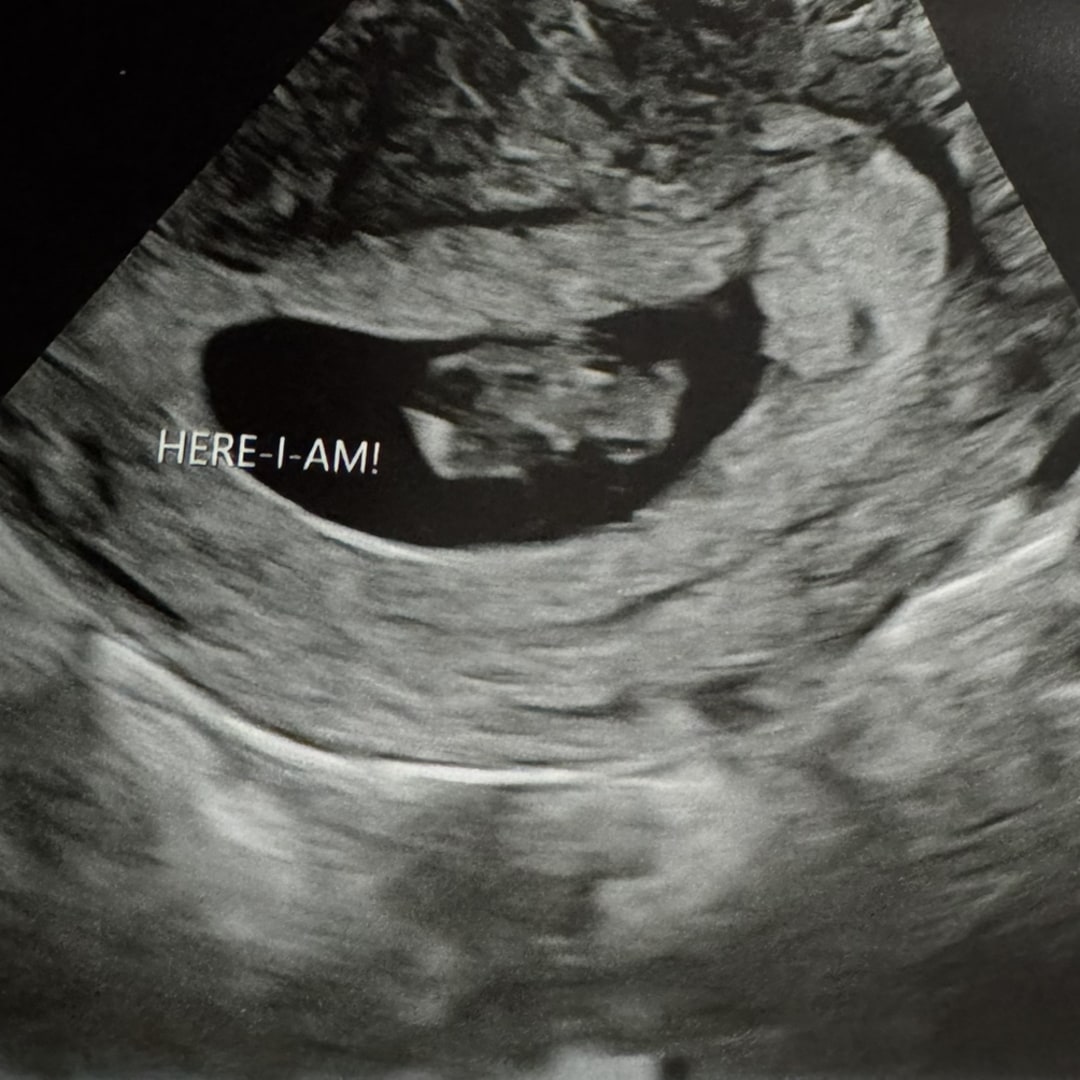 Photo shared by Samantha for their Babylist baby registry.