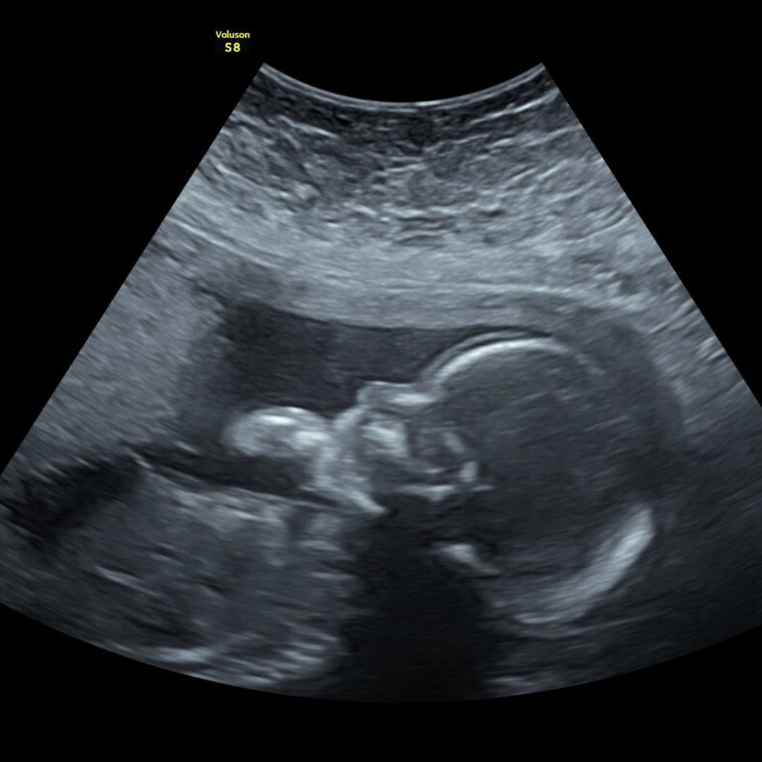 Photo shared by Kaci for their Babylist baby registry.