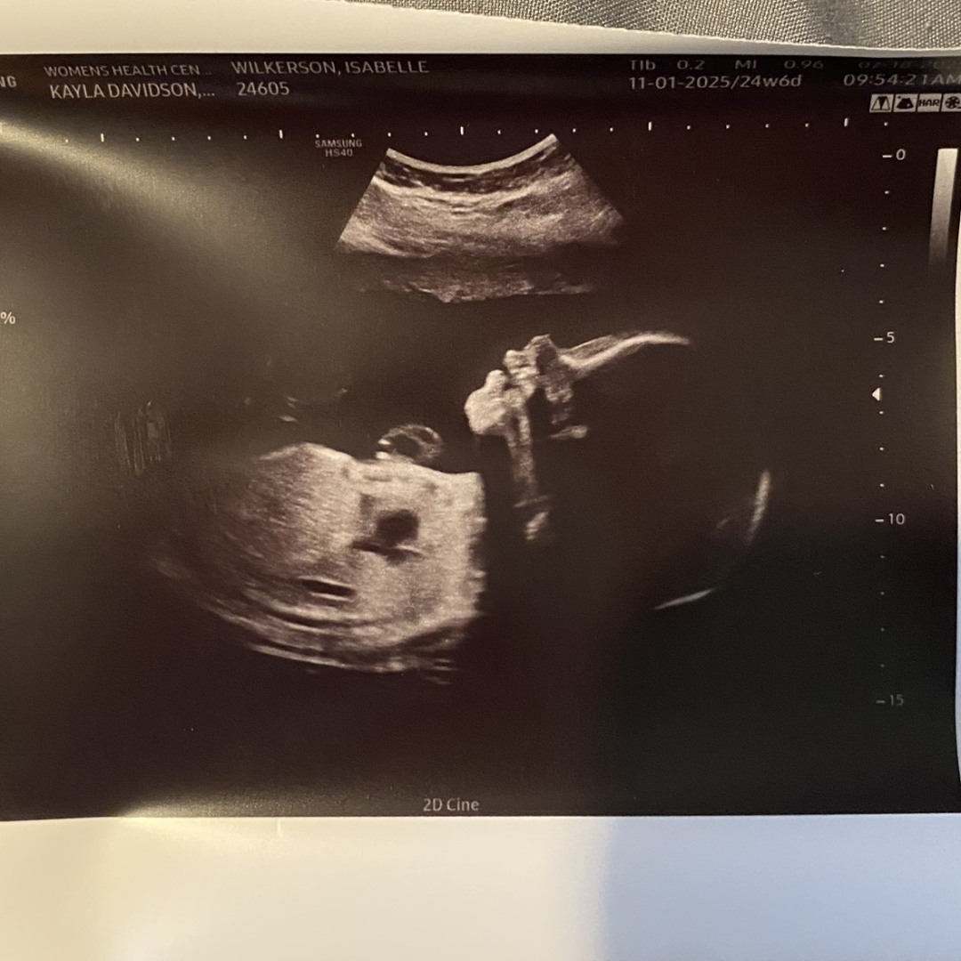 Photo shared by Isabelle for their Babylist baby registry.