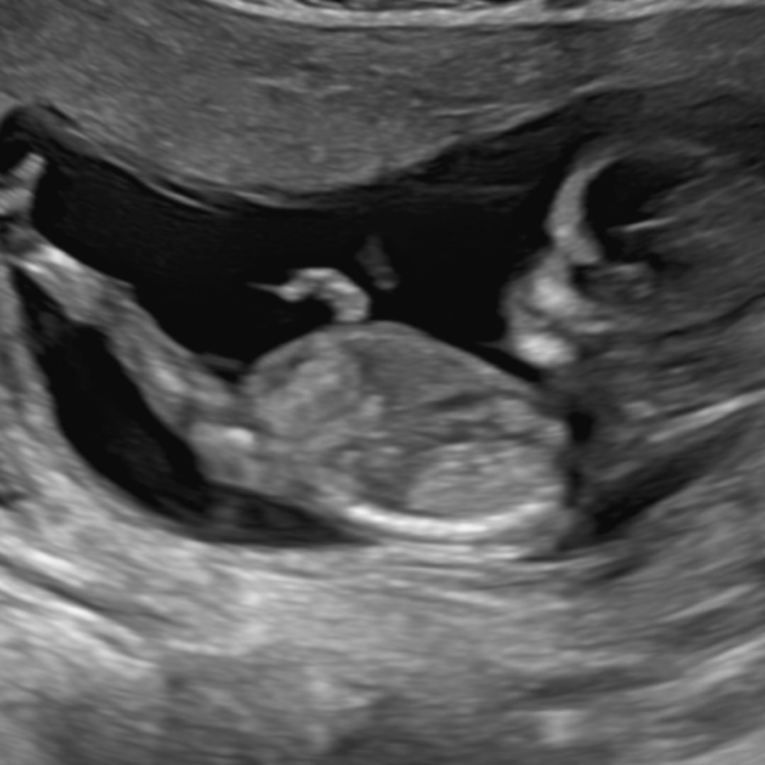 Photo shared by Alicia for their Babylist baby registry.