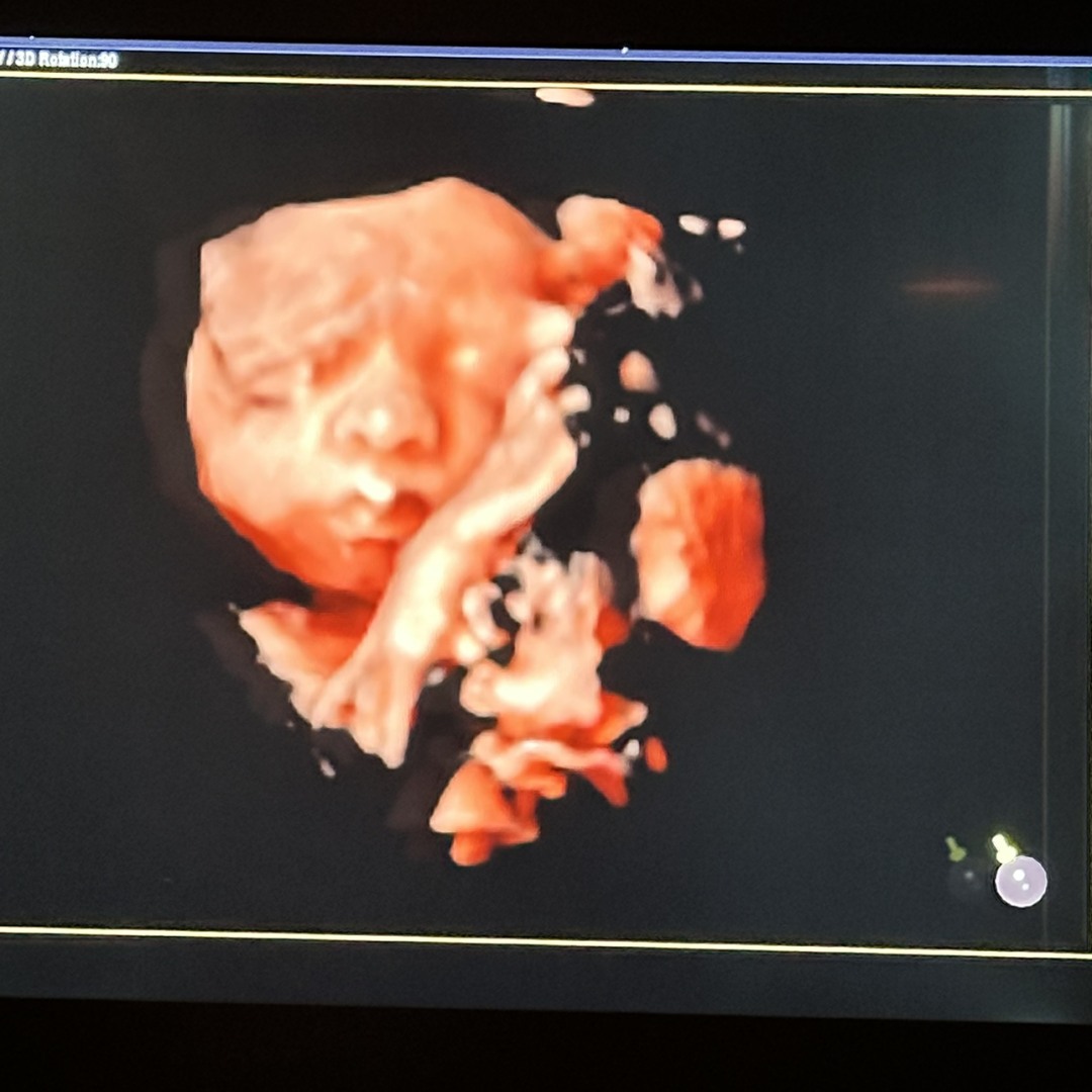 Photo shared by Atya for their Babylist baby registry.