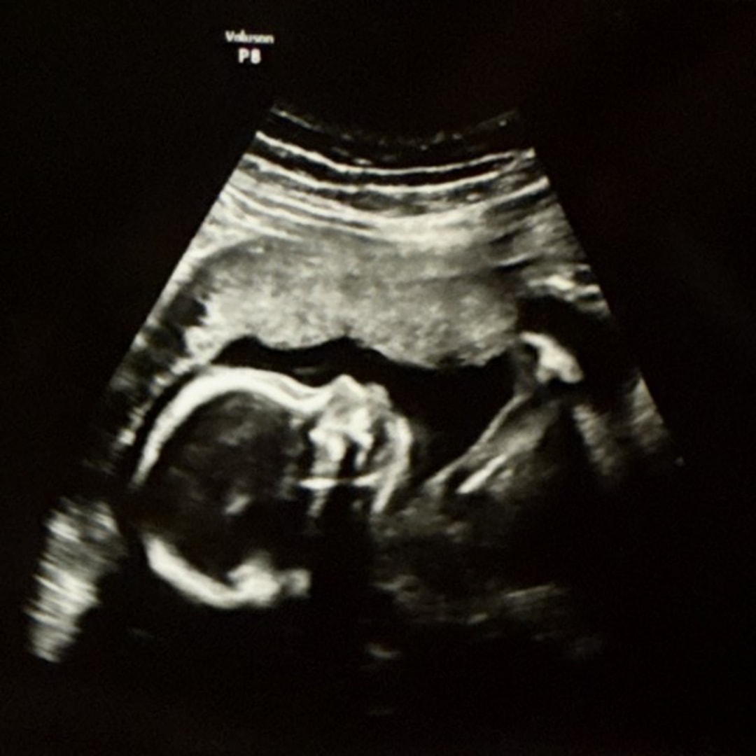 Photo shared by Ricky for their Babylist baby registry.