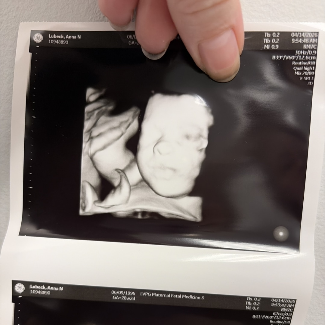 Photo shared by Anna for their Babylist baby registry.