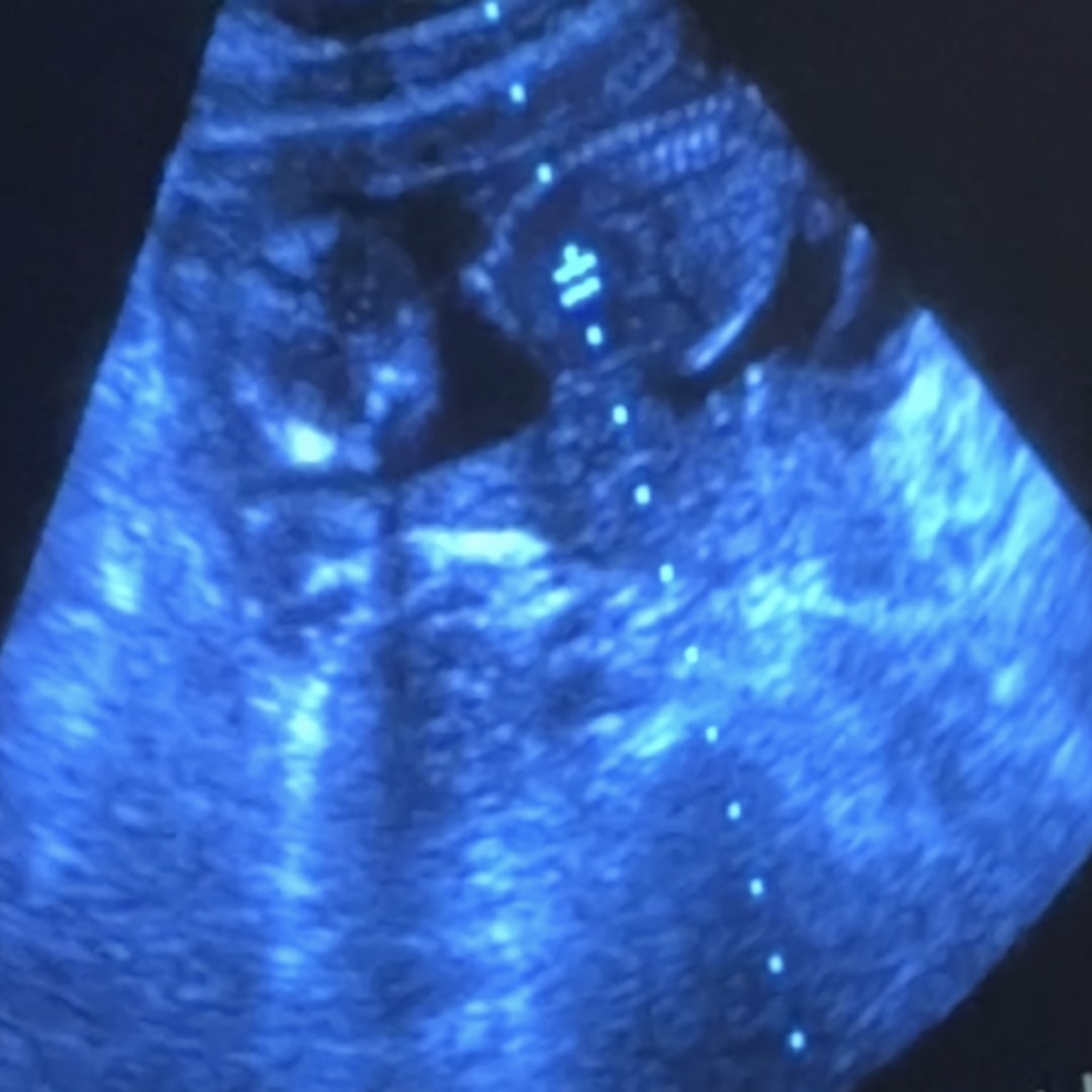 Photo shared by Heather for their Babylist baby registry.