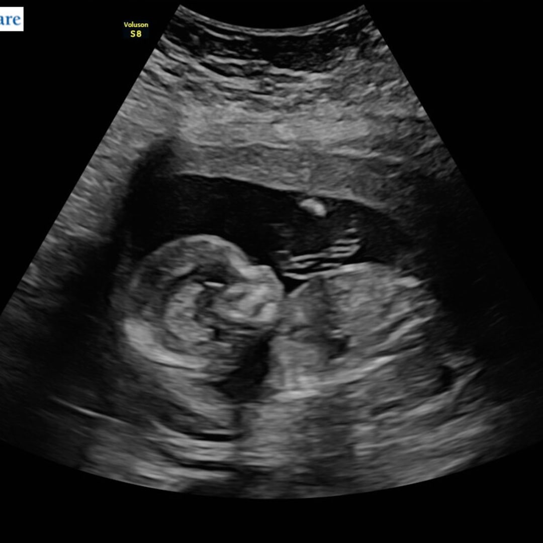 Photo shared by Heather for their Babylist baby registry.