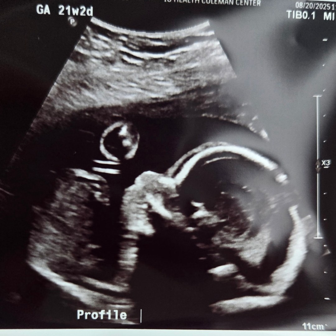 Photo shared by Keara for their Babylist baby registry.