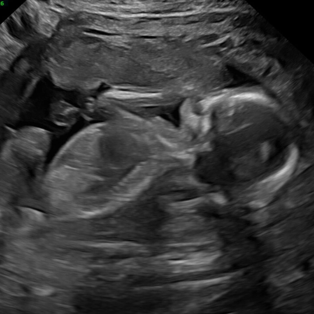 Photo shared by Victoria for their Babylist baby registry.