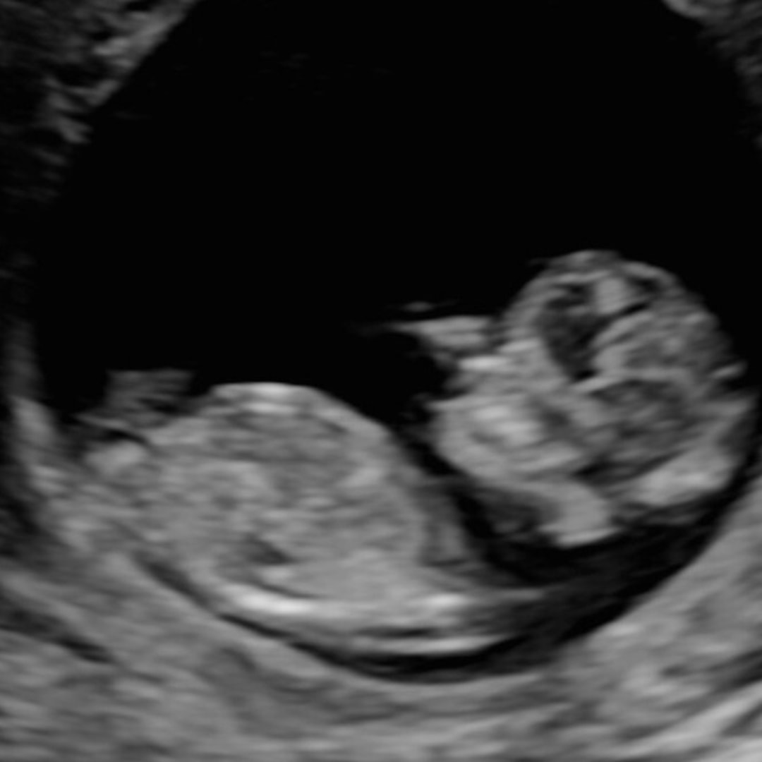 Photo shared by Ashley for their Babylist baby registry.