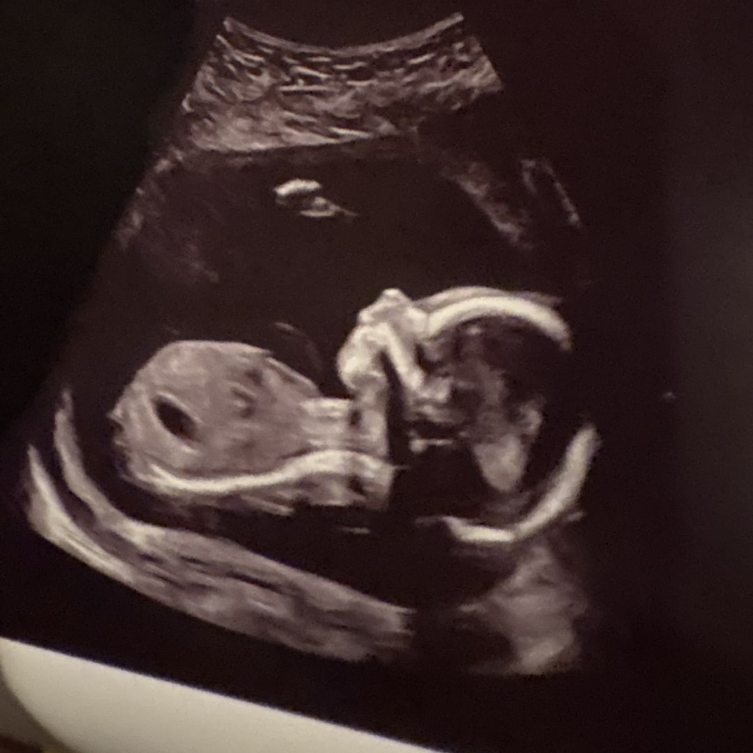 Photo shared by Abby for their Babylist baby registry.