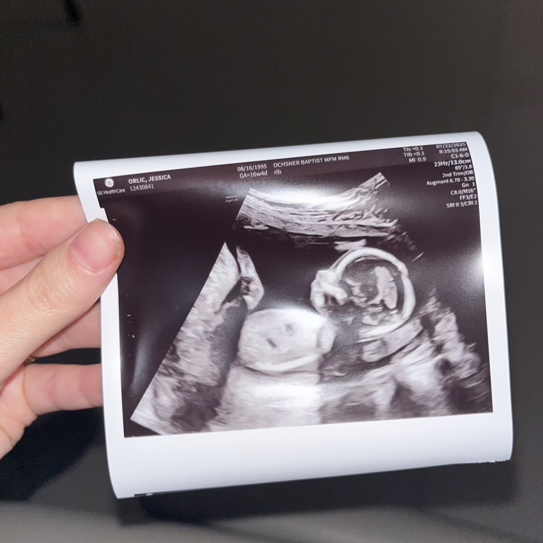 Photo shared by Jessica for their Babylist baby registry.