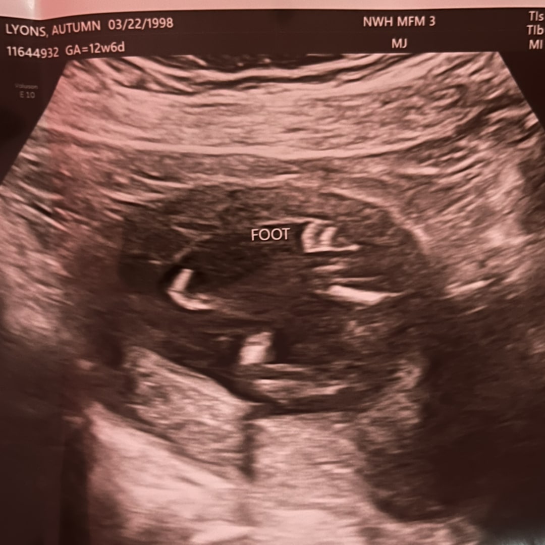 Photo shared by Autumn for their Babylist baby registry.
