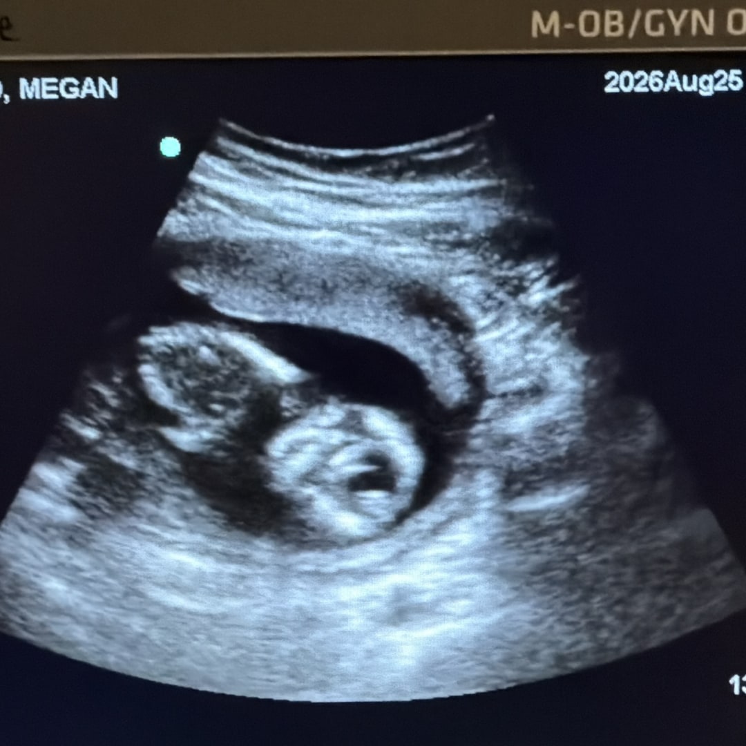 Photo shared by Megan for their Babylist baby registry.