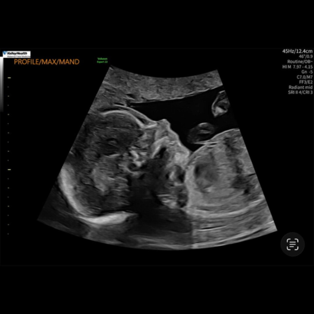 Photo shared by Amanda for their Babylist baby registry.