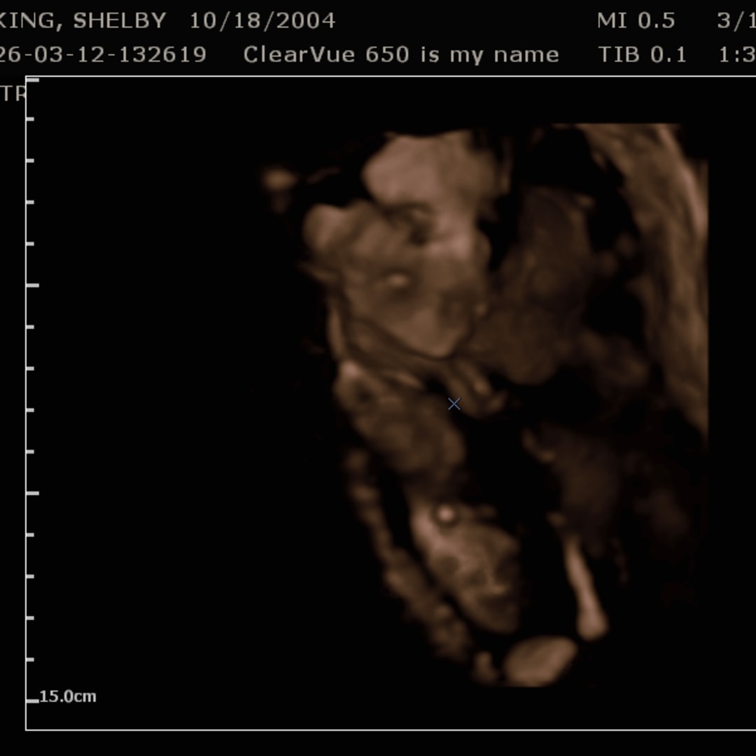 Photo shared by Shelby for their Babylist baby registry.