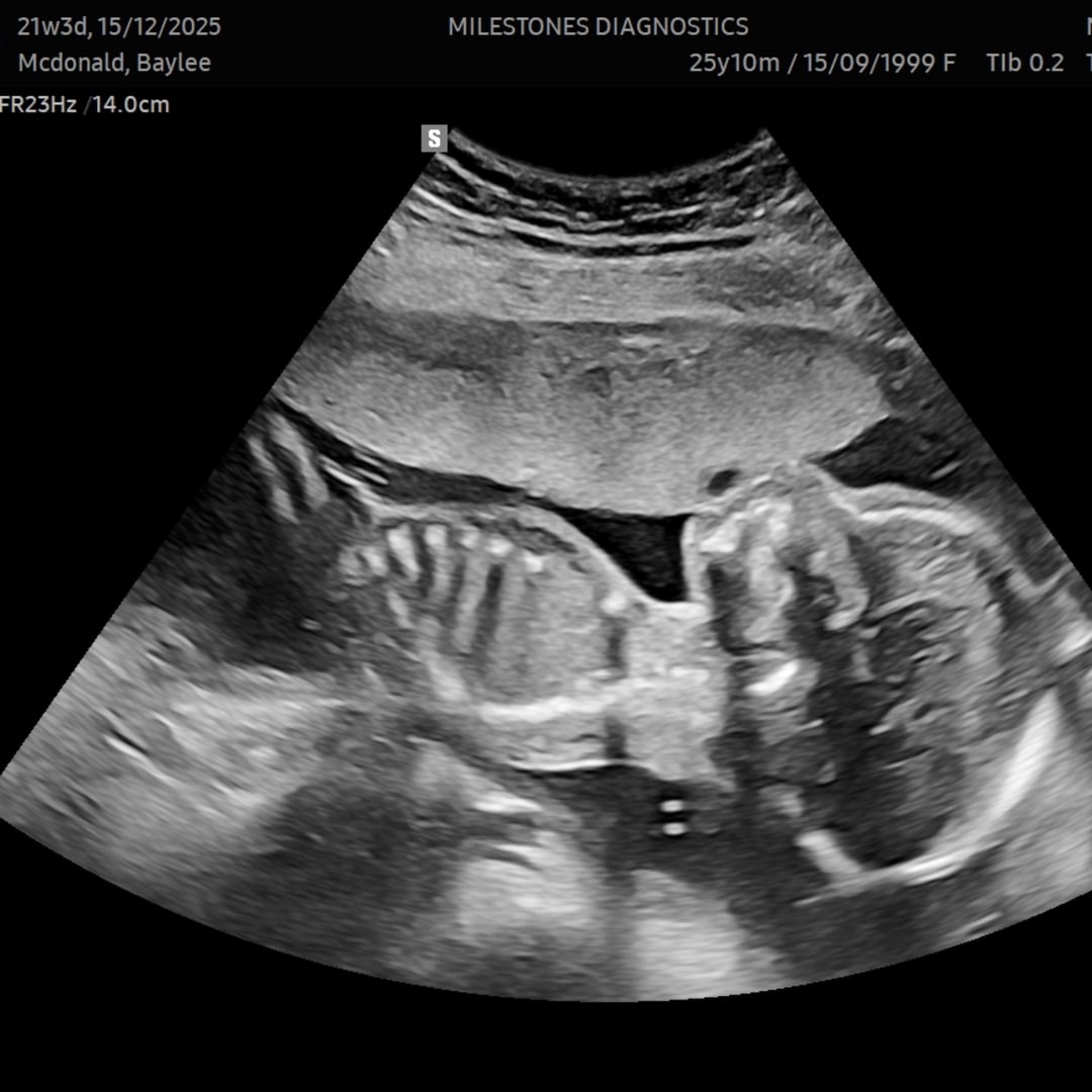 Photo shared by Baylee for their Babylist baby registry.