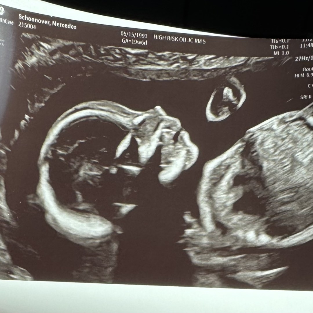 Photo shared by Mercedes for their Babylist baby registry.