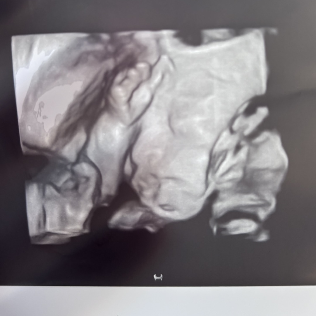 Photo shared by Aatia for their Babylist baby registry.