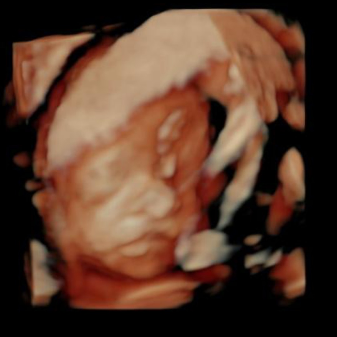 Photo shared by Aliah for their Babylist baby registry.