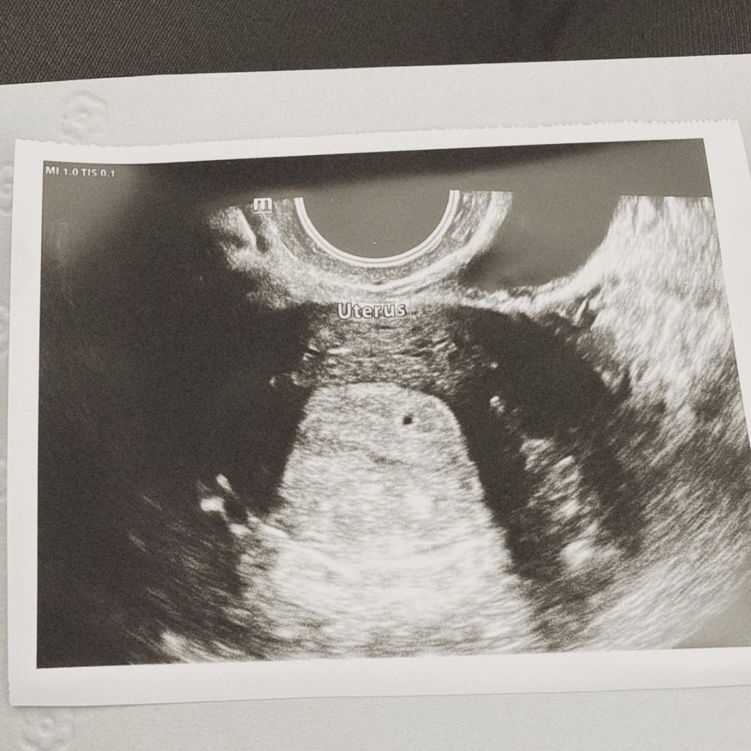 Photo shared by Trista for their Babylist baby registry.