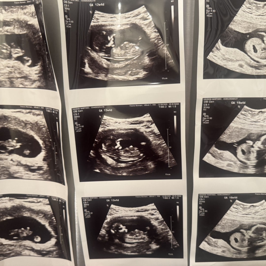 Photo shared by Anna for their Babylist baby registry.