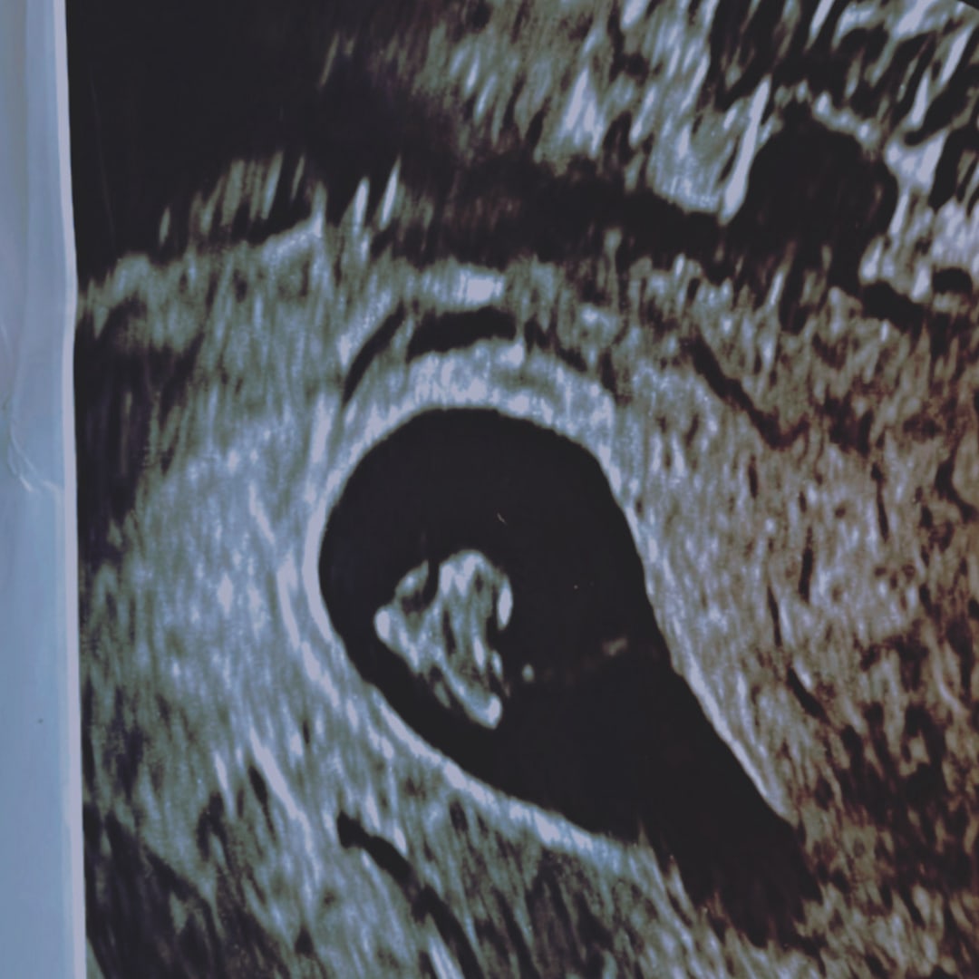 Photo shared by Sasha for their Babylist baby registry.