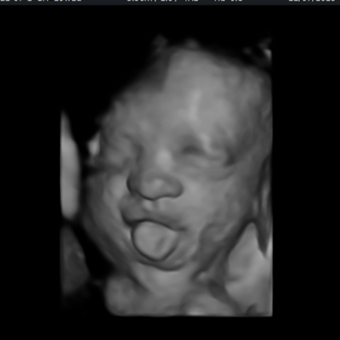 Photo shared by Amanda for their Babylist baby registry.