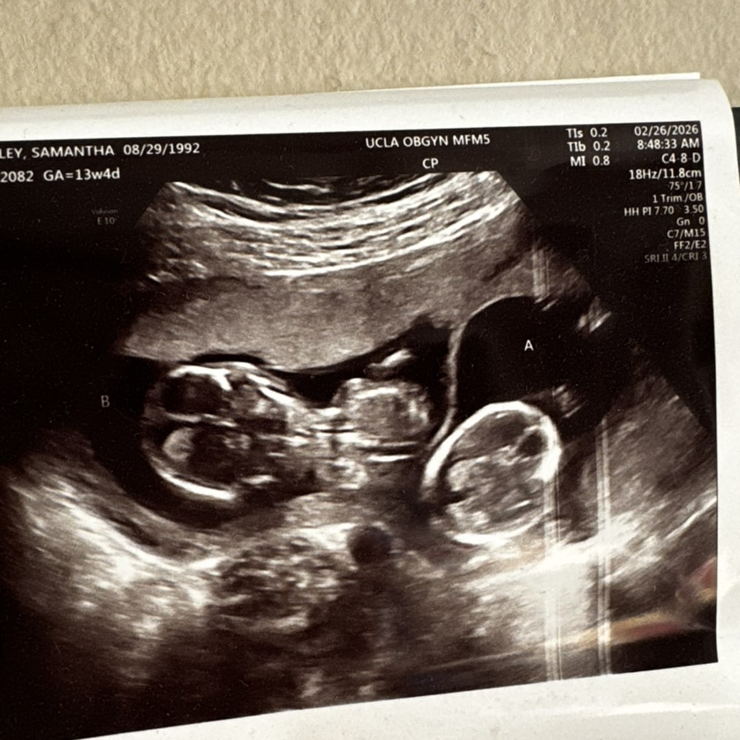 Photo shared by Samantha for their Babylist baby registry.