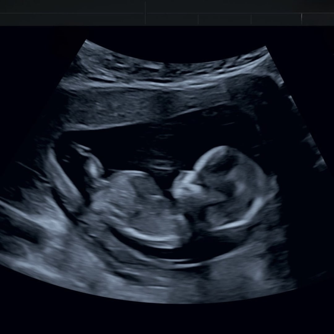 Photo shared by Amena for their Babylist baby registry.