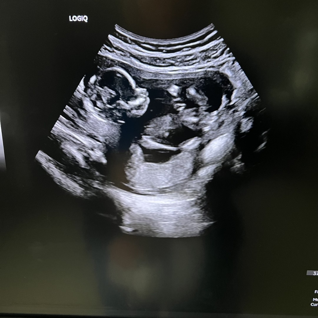 Photo shared by Anna for their Babylist baby registry.