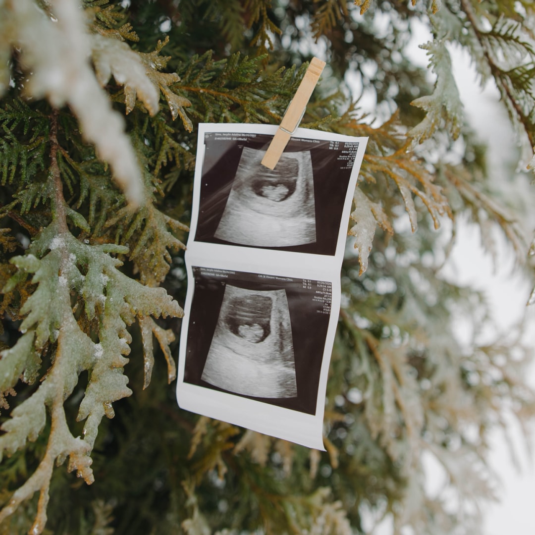 Photo shared by Adi for their Babylist baby registry.