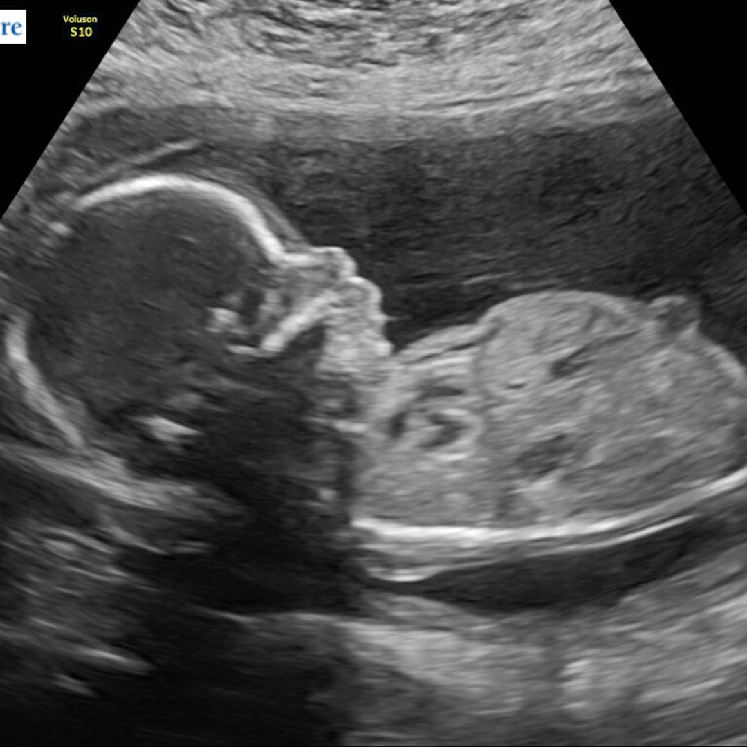 Photo shared by Emily for their Babylist baby registry.