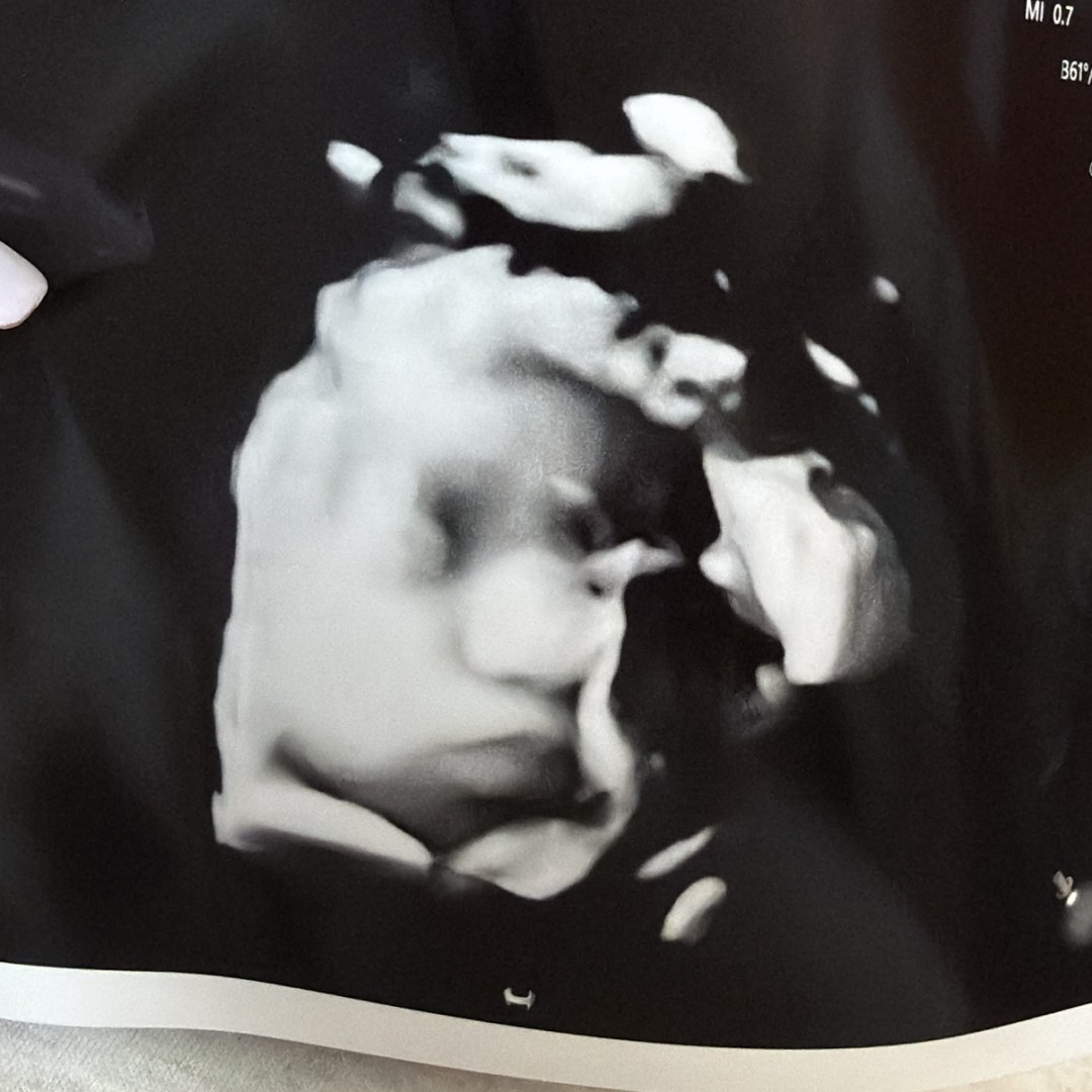 Photo shared by Duygu for their Babylist baby registry.
