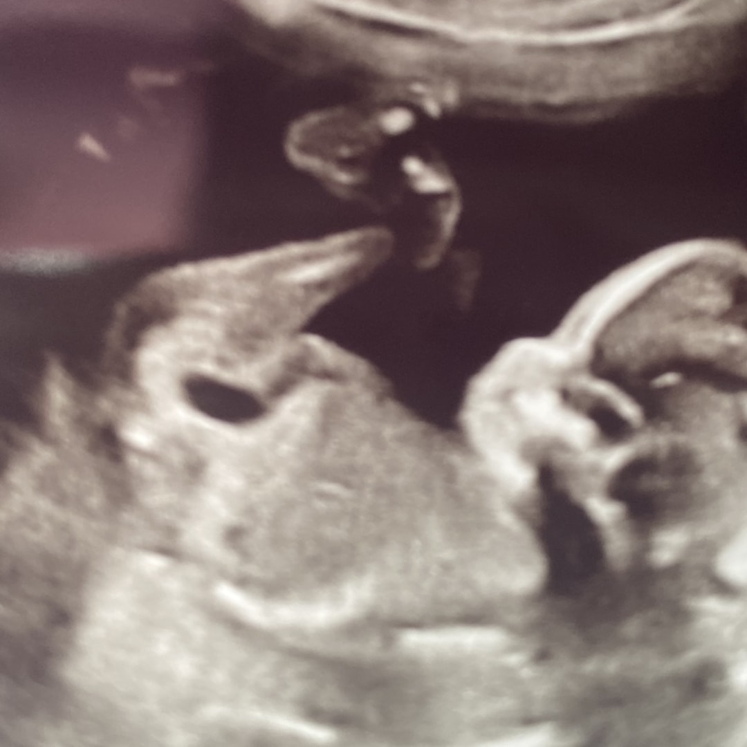Photo shared by Carmelina for their Babylist baby registry.