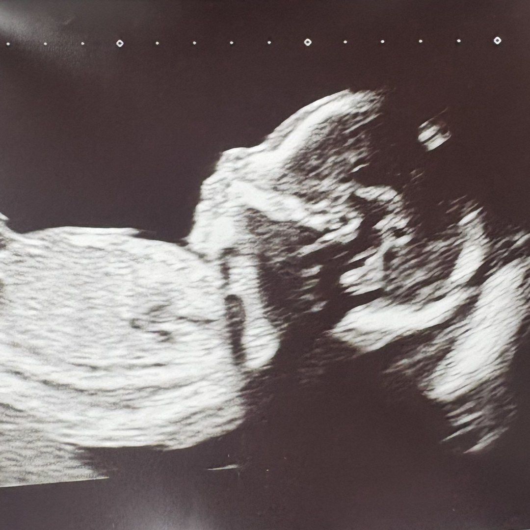 Photo shared by Cindy for their Babylist baby registry.