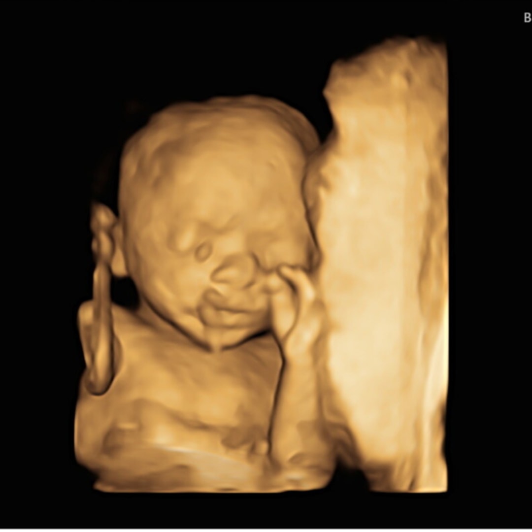 Photo shared by Alexis for their Babylist baby registry.