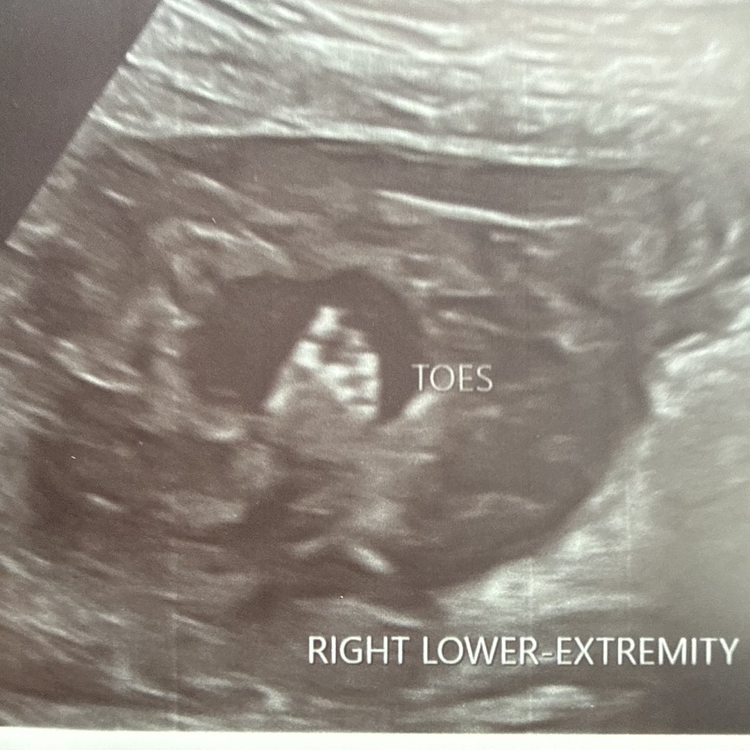 Photo shared by Maegan for their Babylist baby registry.