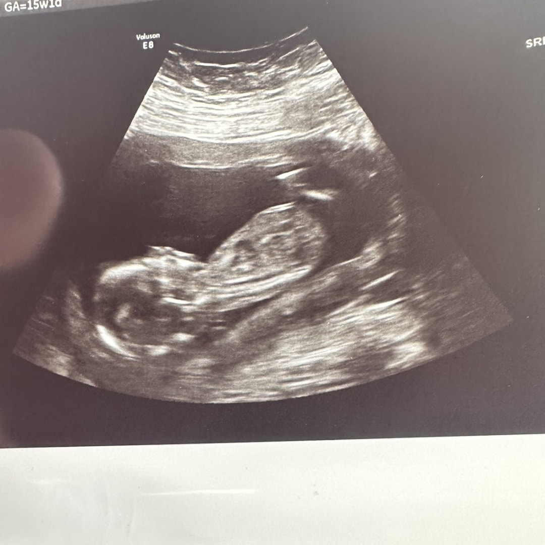 Photo shared by Sabrina for their Babylist baby registry.