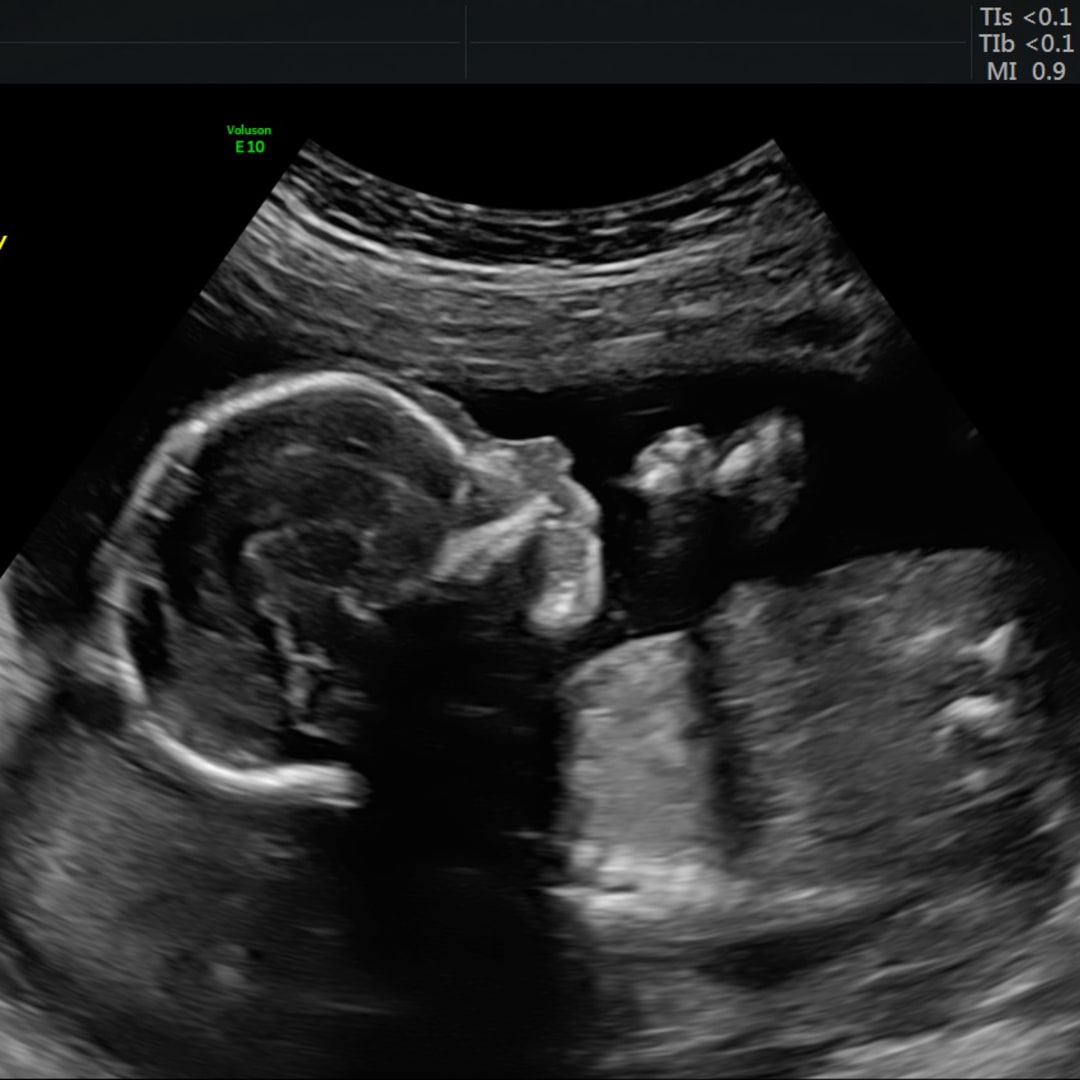 Photo shared by Alyssa for their Babylist baby registry.