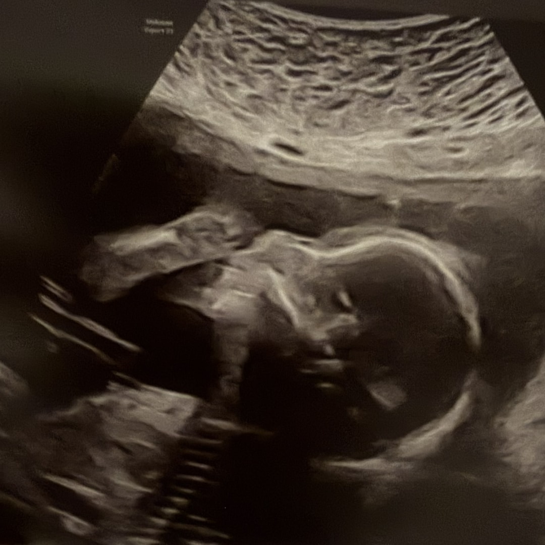 Photo shared by Rebecca for their Babylist baby registry.