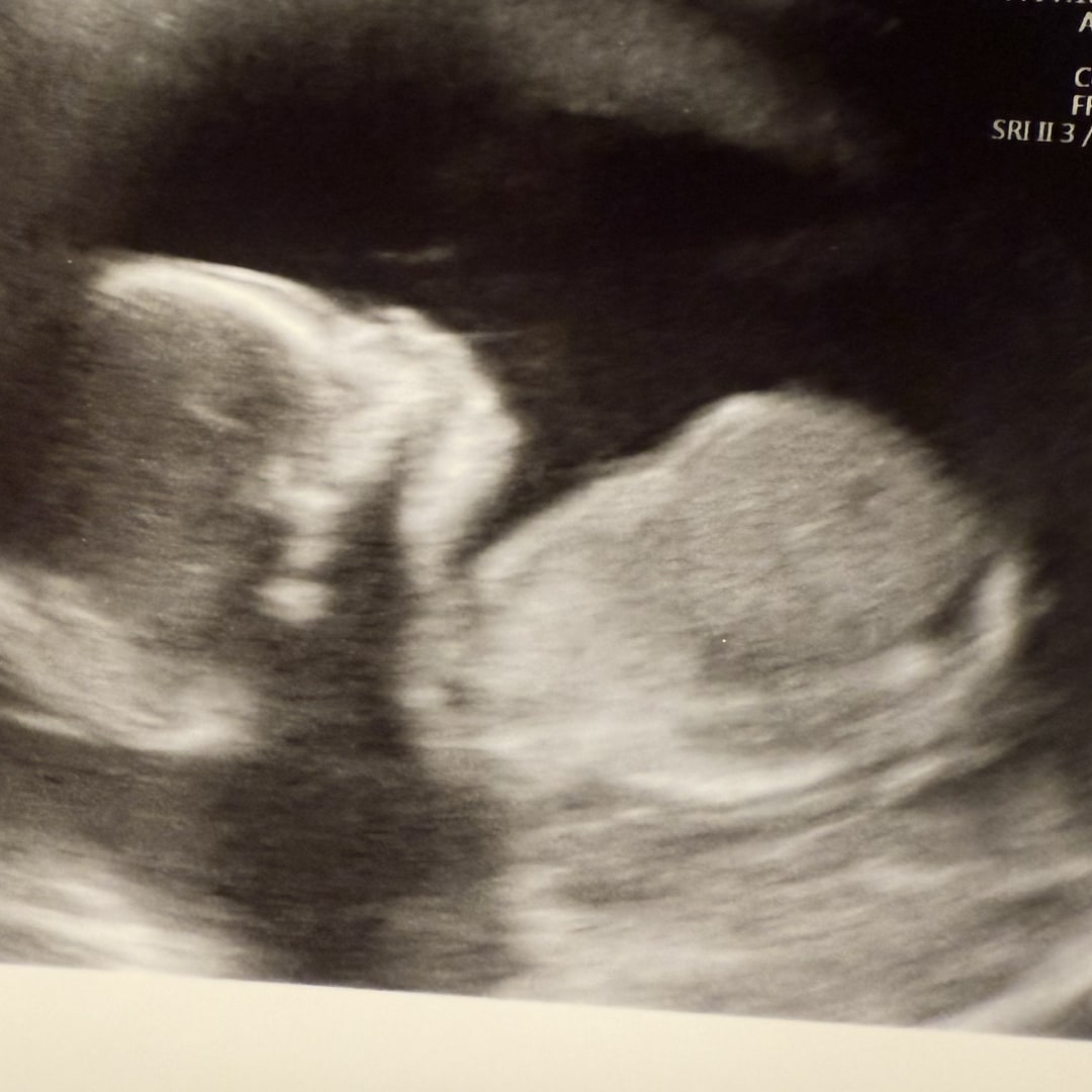 Photo shared by Kylie for their Babylist baby registry.
