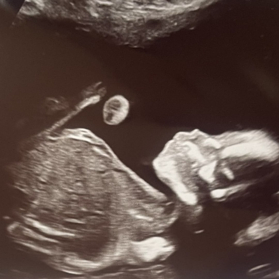 Photo shared by Ashley for their Babylist baby registry.