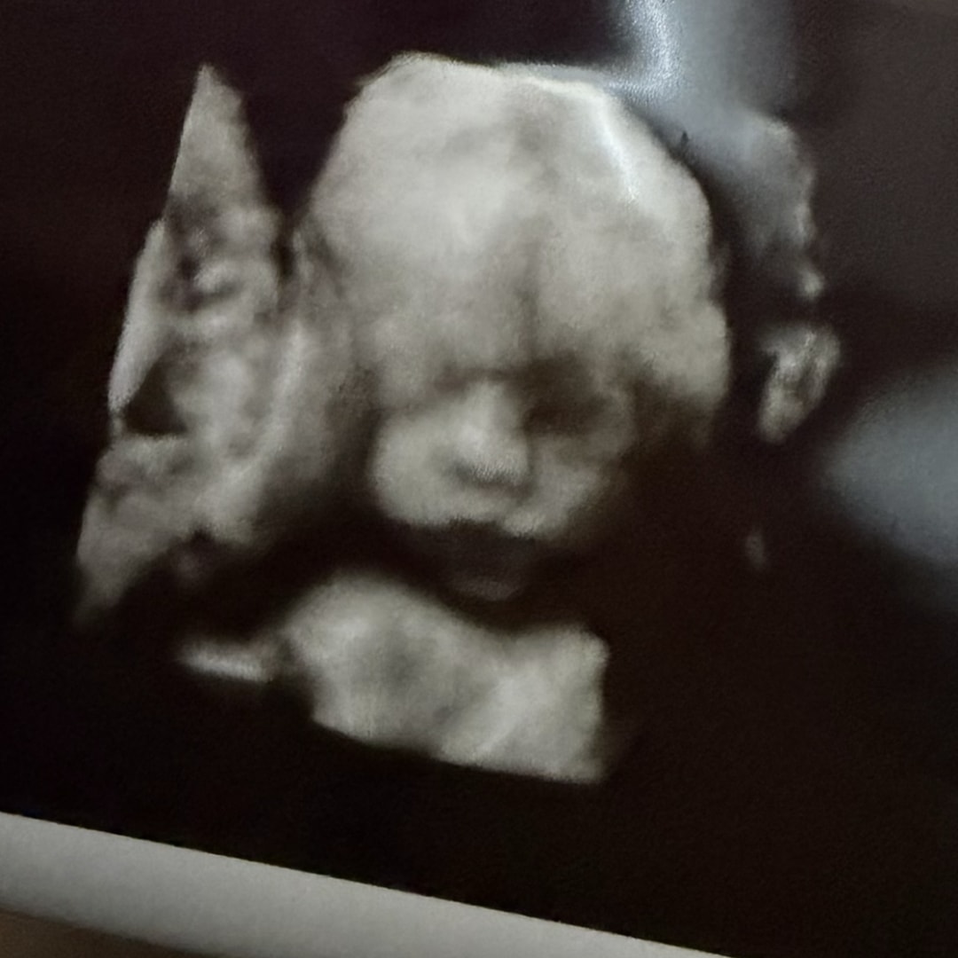 Photo shared by Angela for their Babylist baby registry.