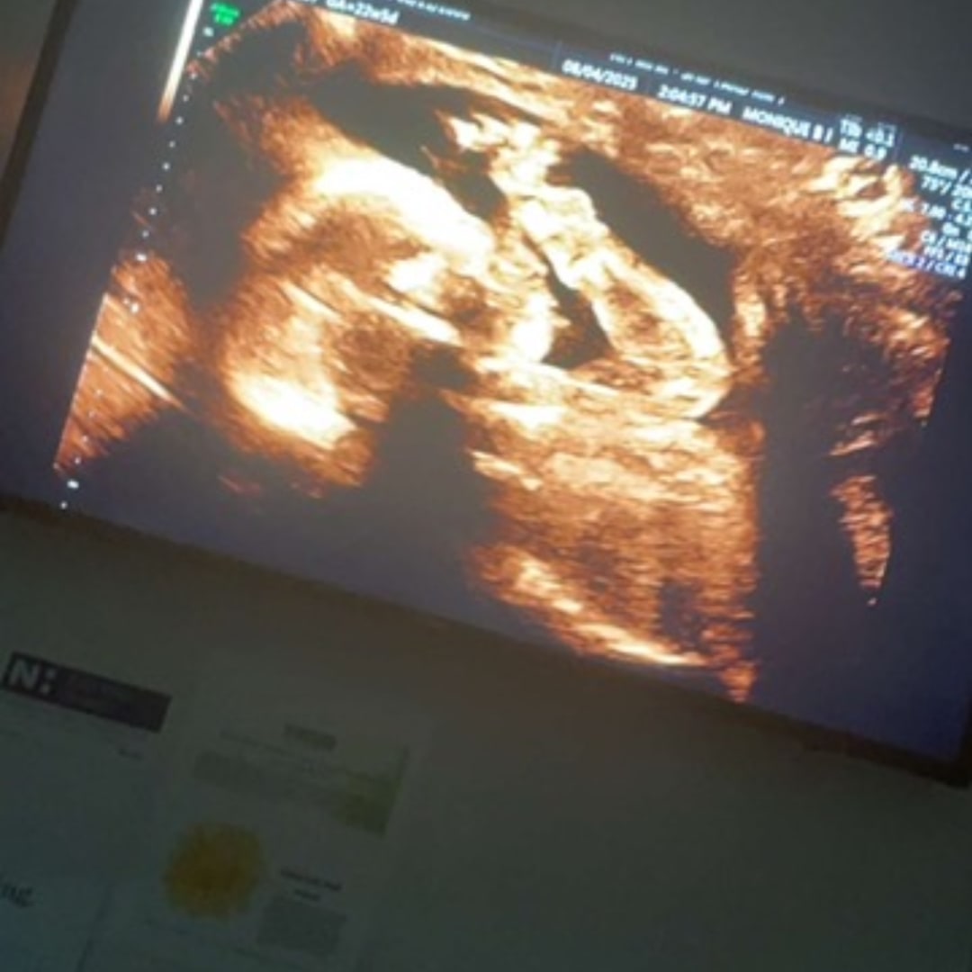 Photo shared by Jazmin for their Babylist baby registry.