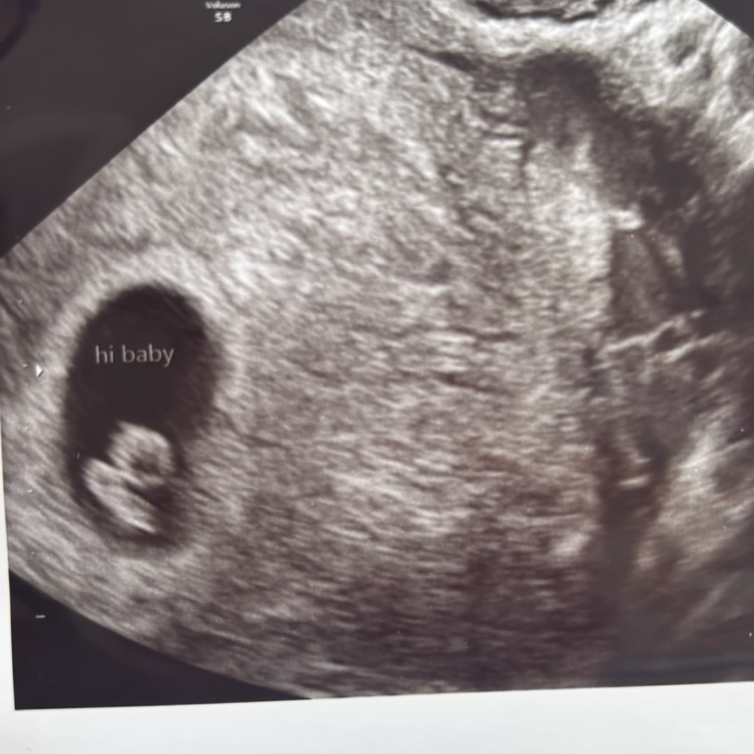 Photo shared by Irene for their Babylist baby registry.